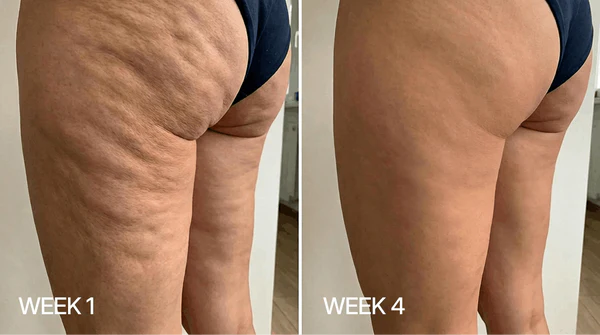 Weekly Skin Results